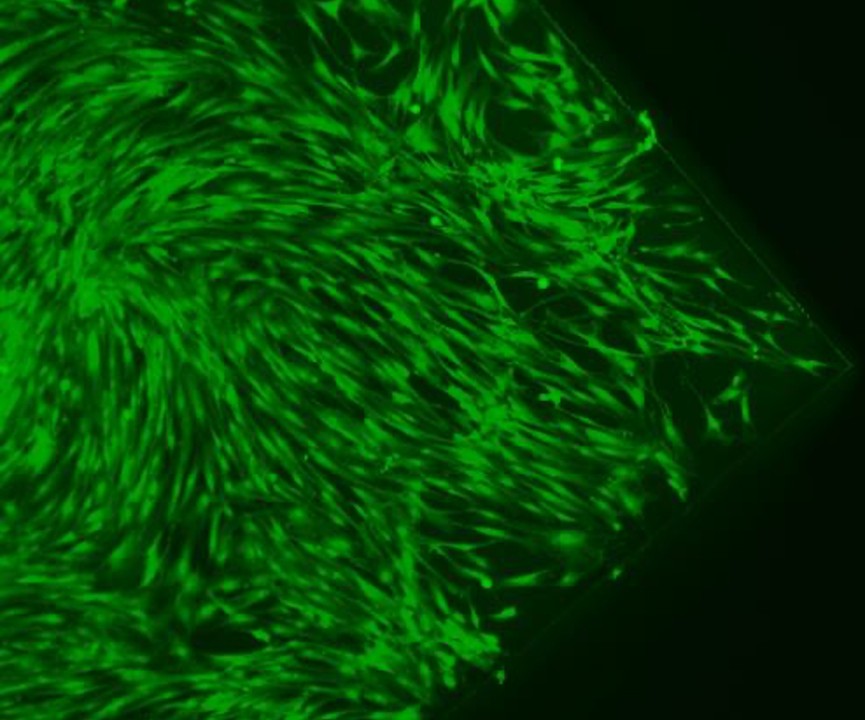  ENEA sperimenta un metodo innovativo per rigenerare le lesioni del midollo spinale